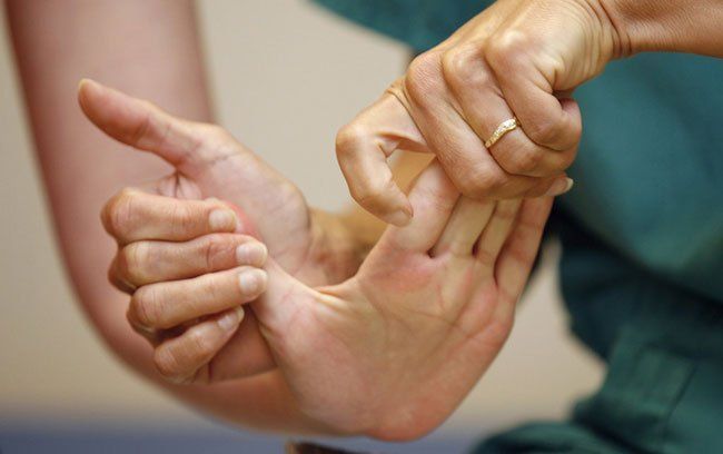 Миостимуляция руки после инсульта